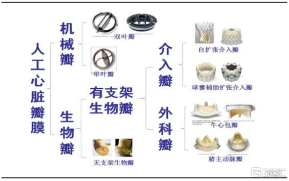 人工心脏瓣膜产品分类