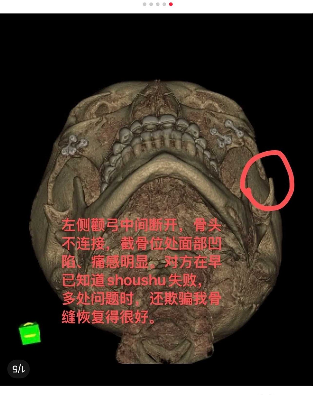 get?code=ZjQ5NTg2NWIzMmQzMTU3ZWNhZjQxZjcwZjY4N2NmZTksMTczODgyMjI5NzA0Mw==