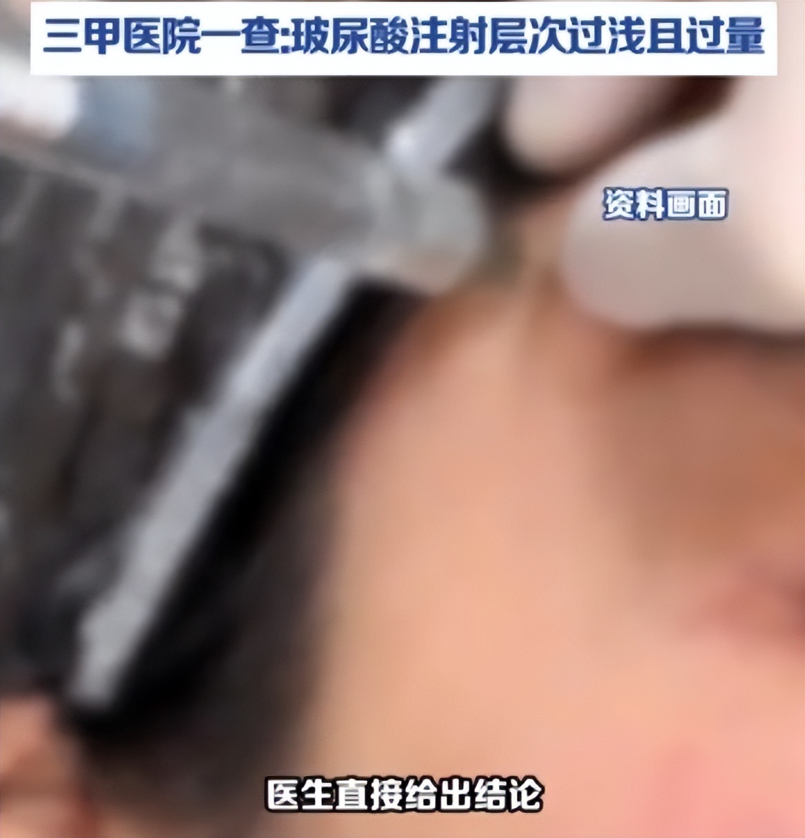 get?code=YTY1MGI4MDUwNzJkZWU2ODY3YTlkMDIxNDEzNzgzYzksMTc3NDc0OTIyMDE1NA==