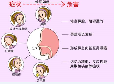 德國elveato無菌生理性海水鼻腔噴霧器帶你進入無菌洗鼻器