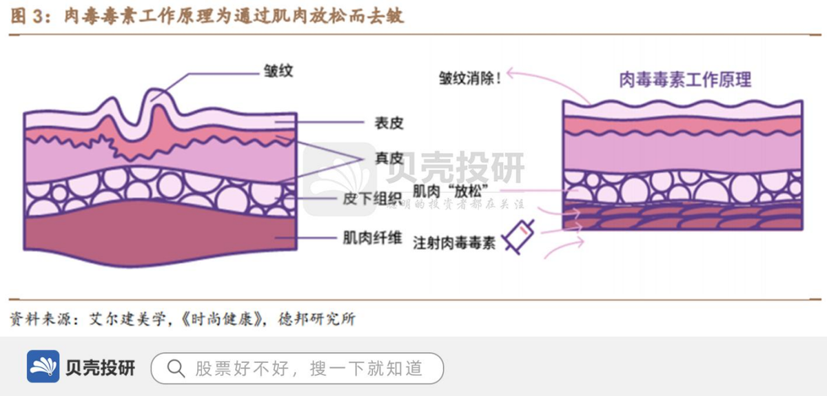除皱,瘦脸,瘦腿等功能.