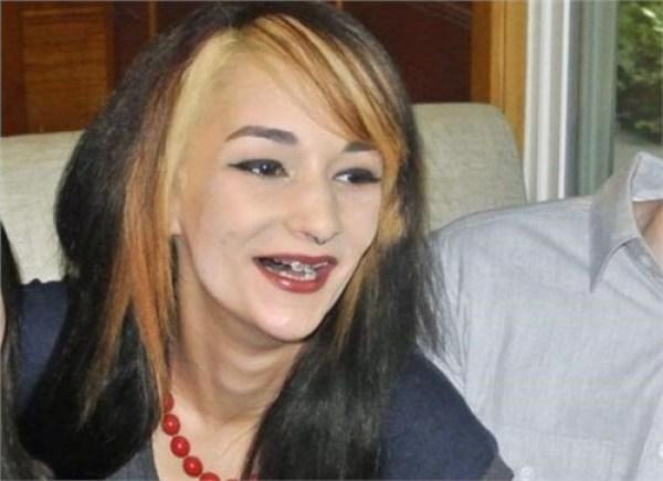 女子天生长着一副鲨鱼牙齿自卑了10年都不敢笑如今解脱