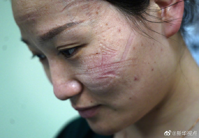 向他们脸上最美的印痕致敬