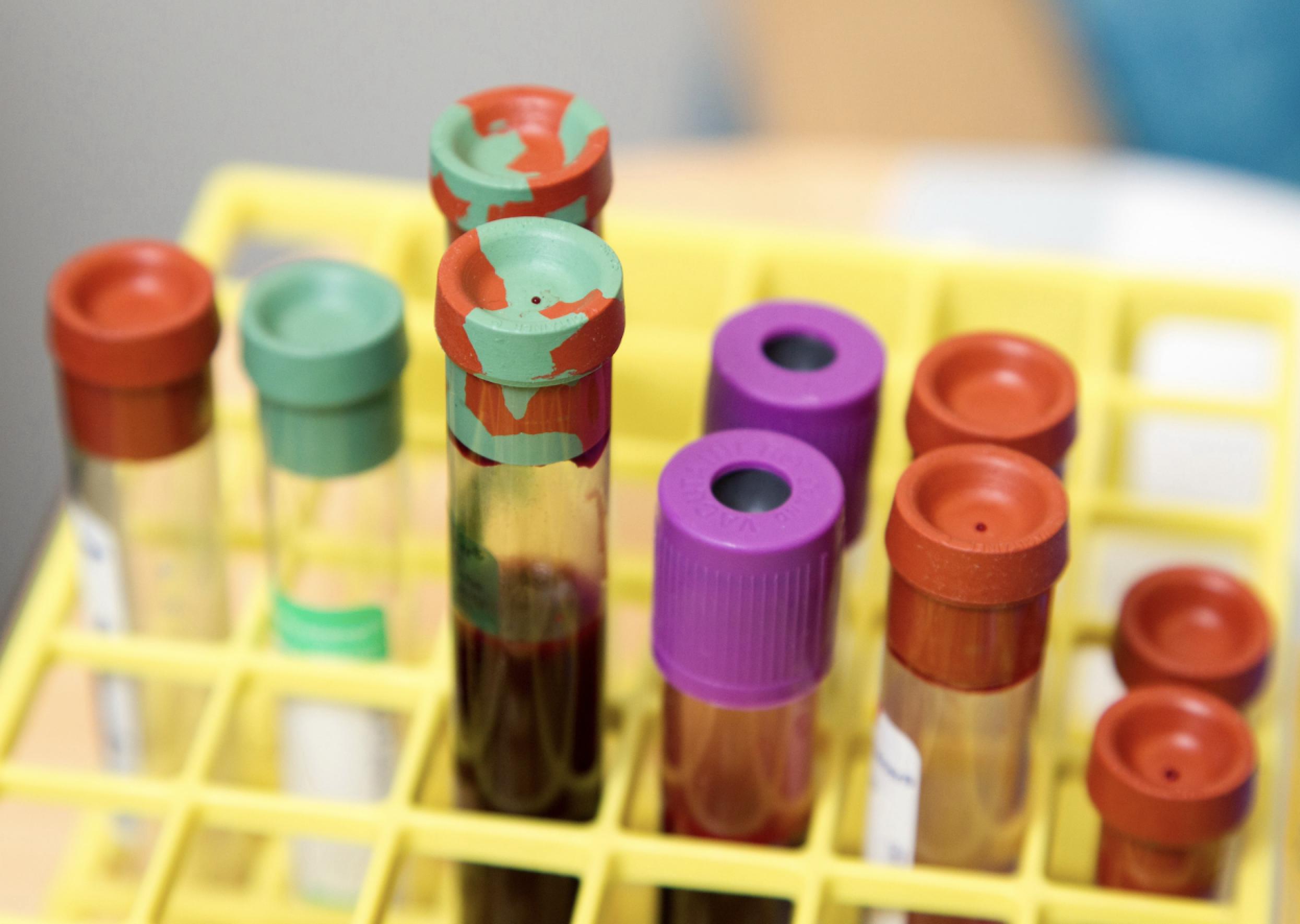 南京新百子公司拟1300万美元购国际脐带血库200万股