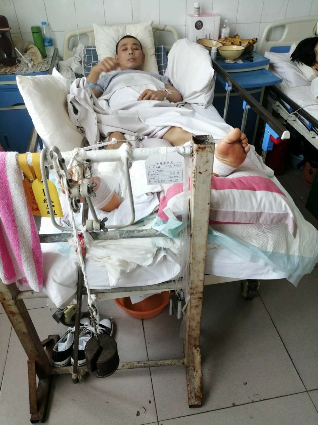 汝州男子工地干活被砸断双腿却遭维权无门 事发工地系违法施工