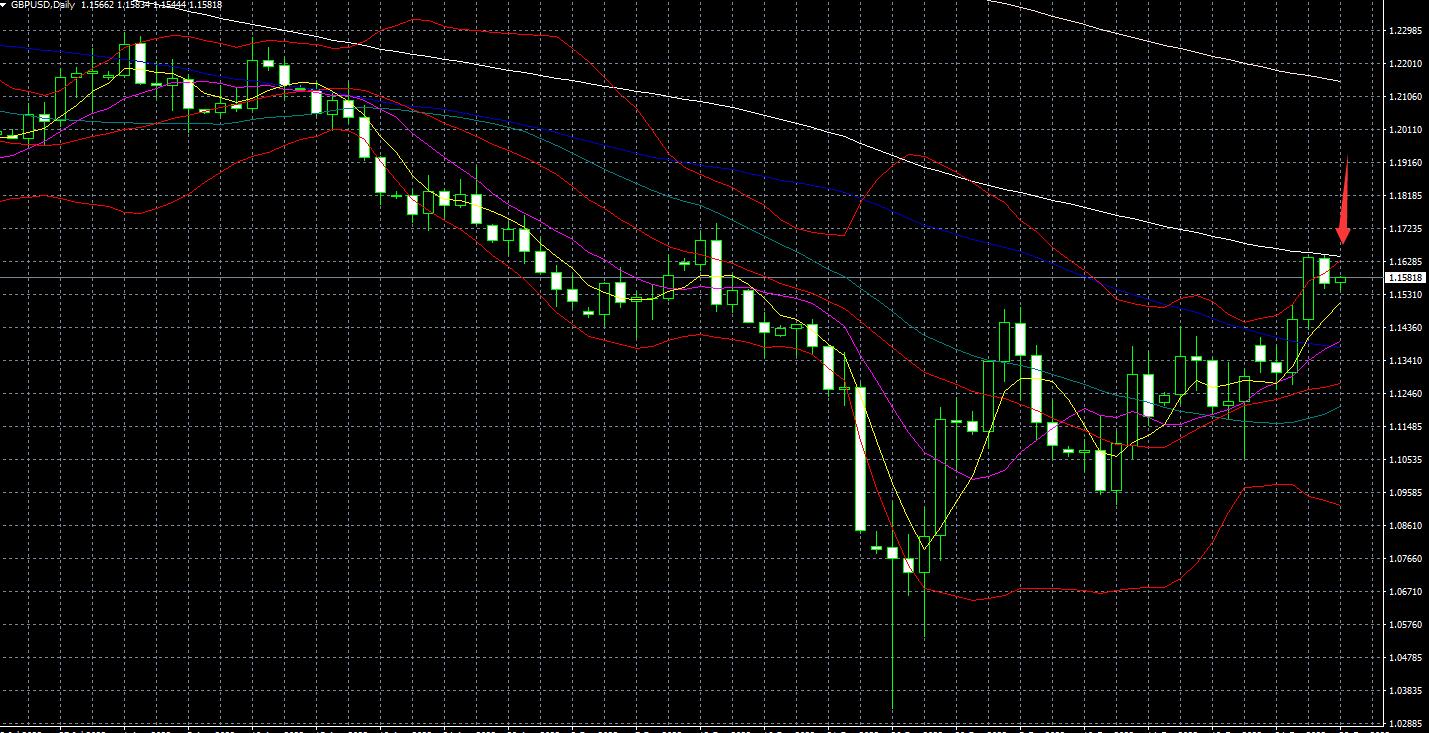 2022年10月28日黄金英镑分析